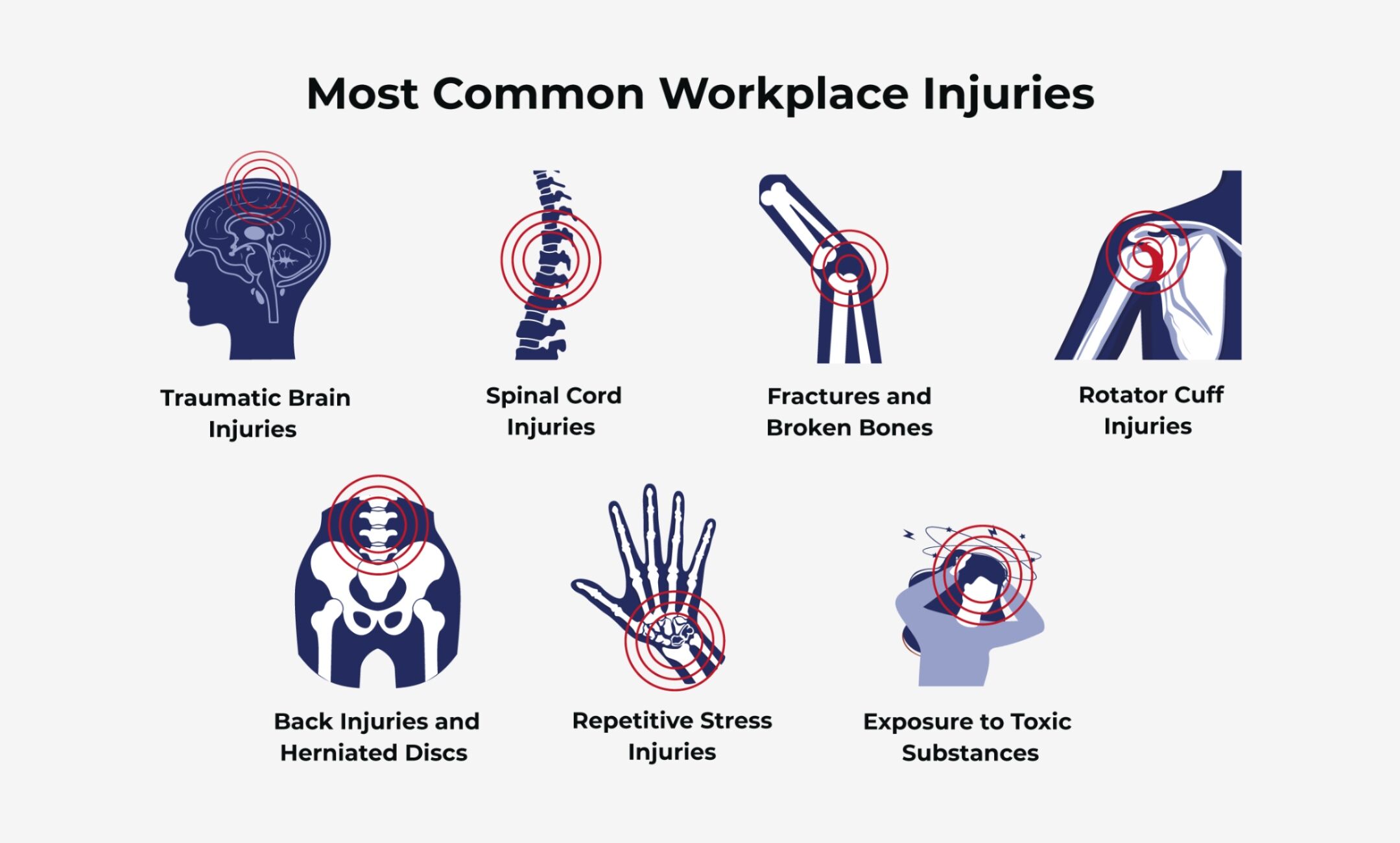 Common Work Injuries That Drive Legal Proceedings